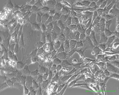 Personalized Cell Lines for Chemo Drug Selection