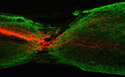 Regeneration of Mouse Corticospinal Tract Axons