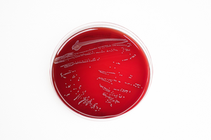 Enterococcus faecium bacteria colony