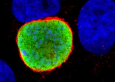 Liver Stage Malaria