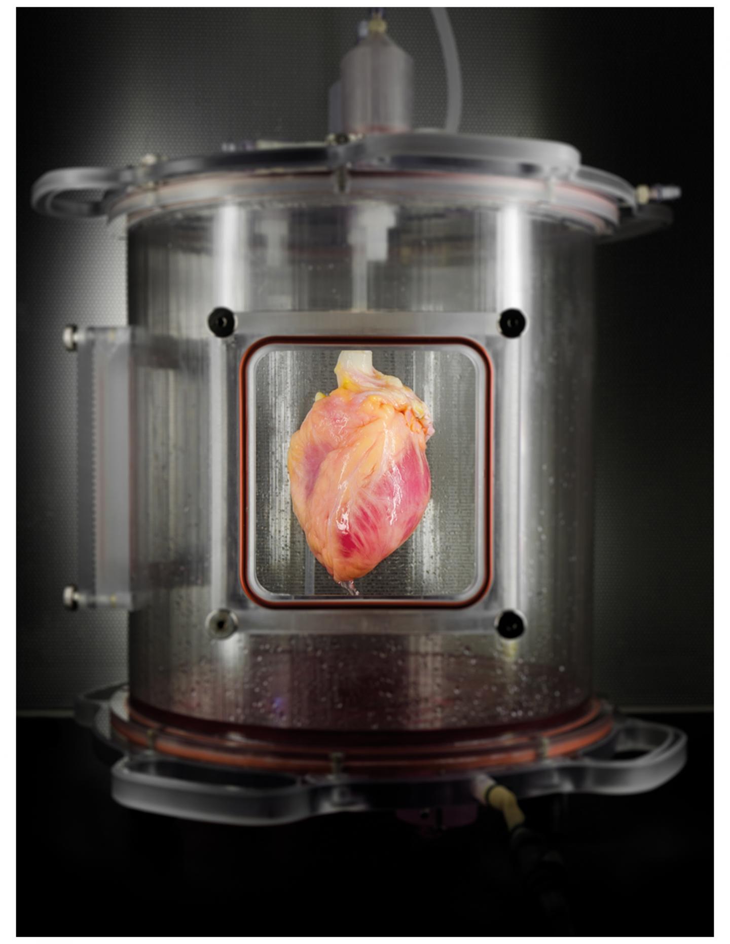 Partially Recellularized Heart Scaffold in Bioreactor