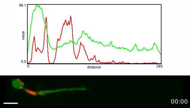 Migrating Interneuron