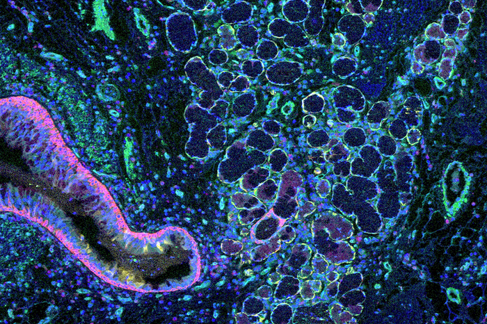 New Computational Method Builds Detailed Maps of Human Tissues