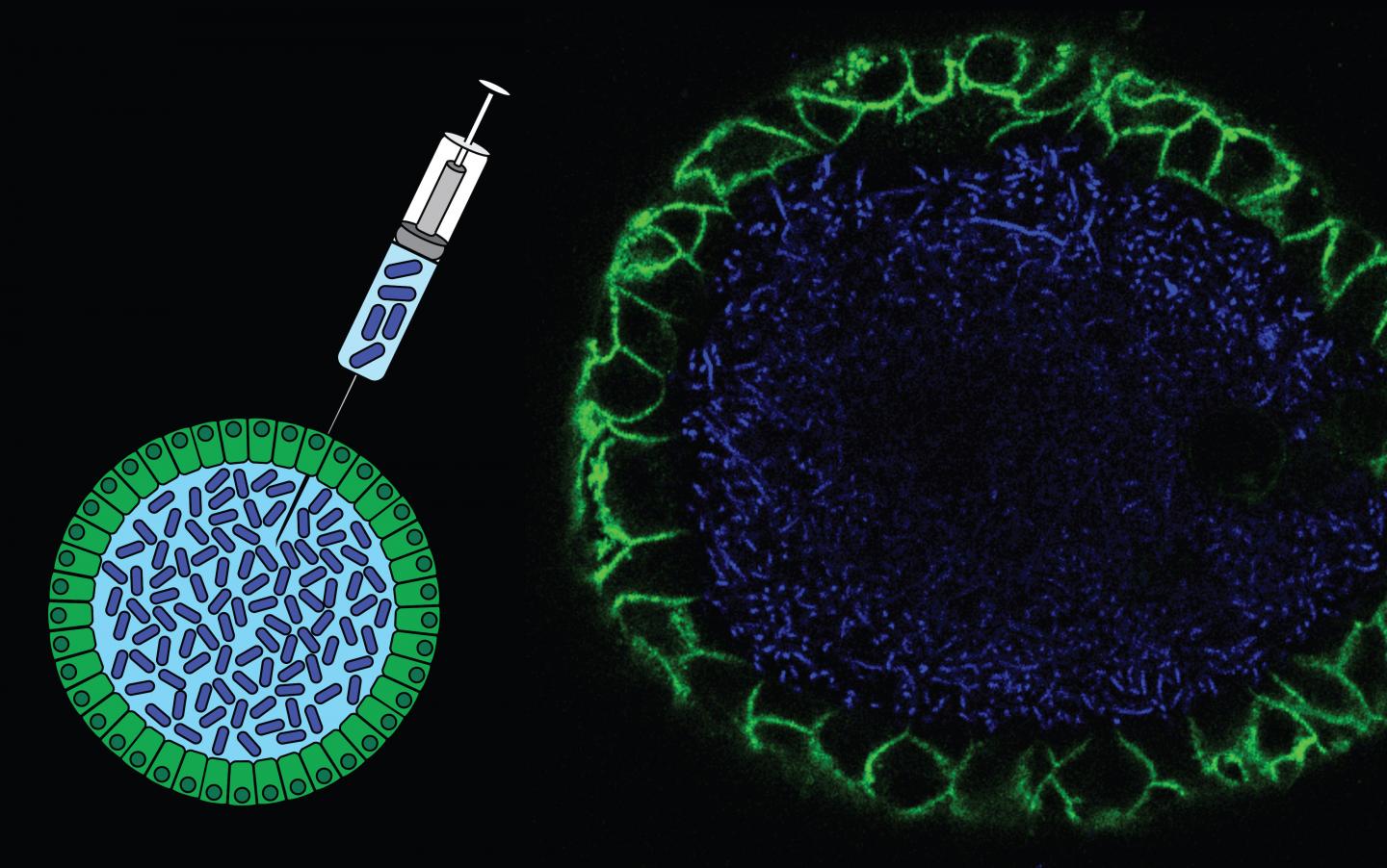 Injection of Bacteria in An Organoid