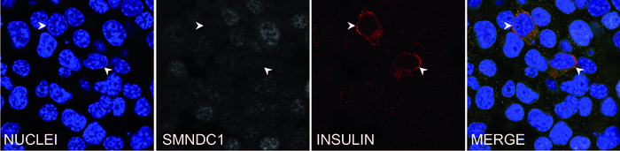 Induction of insulin protein