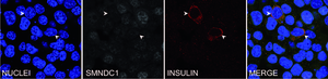 Induction of insulin protein