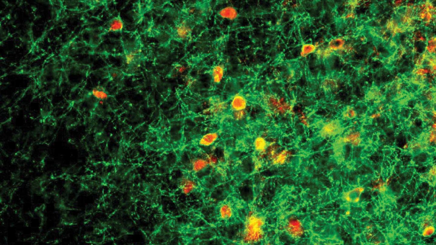 Parvalbumin (PV) Neurons in the Auditory Cortex