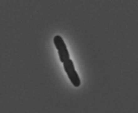 Division of <em>E. coli</em> Bacteria under the Microscope