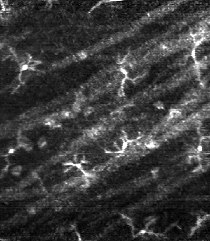 Macrophage cells resolved in a human eye with a label-free adaptive optics imaging technique.