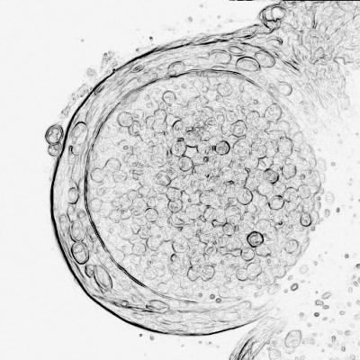 A Gene for the Amoeba's Sexual Fate (2 of 6)