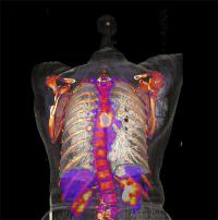 CT Scan of Human Torso