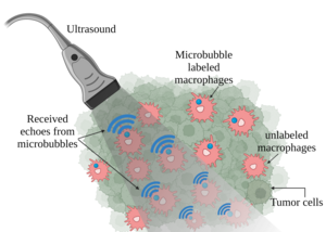 Attaching microbubbles to macrophages can create high-resolution and sensitive tracking images