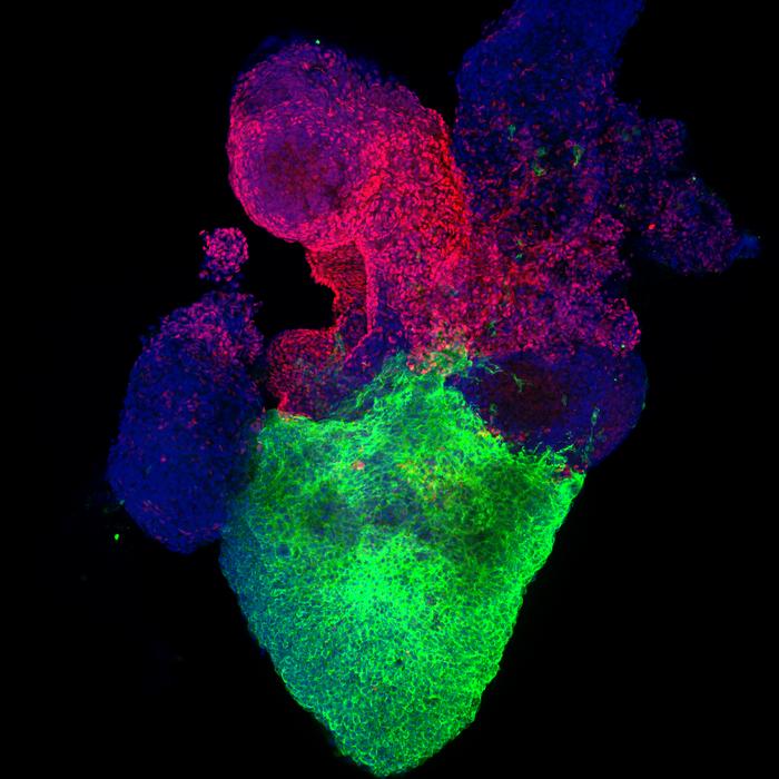 Heart organoid