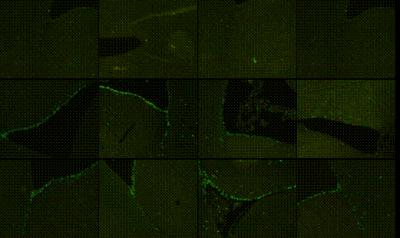 Neural Stem Cells in the Subependymal Zone of Vascular Dementia Rats