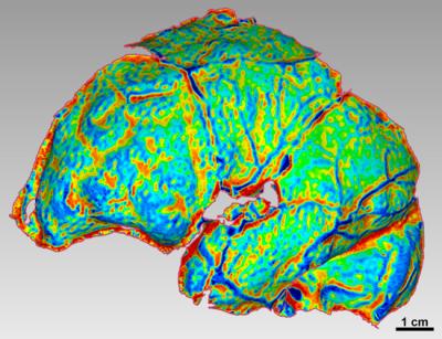 Curvature Map of a <i>Homo naledi</i> Cranial Endocast