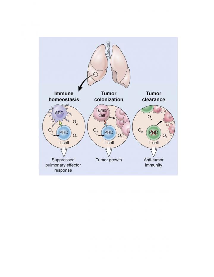 Graphical Description of Lung Metastasis Via PhD Cells