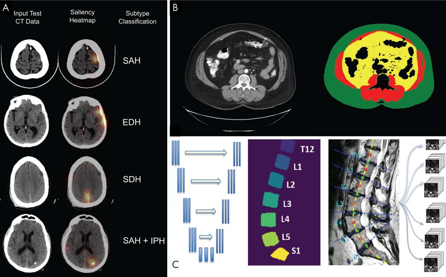 Data Science Pathway Prepares Radiology Residents for Machine Learning