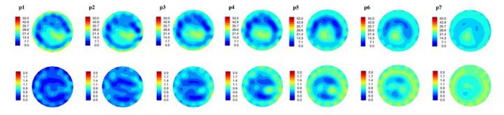 Microwave Imaging of the Breast