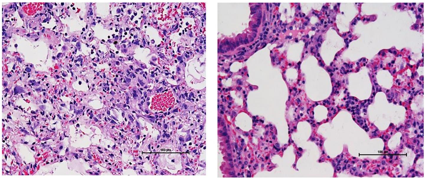 Nox2 Inhibitor Prevents Lung Damage