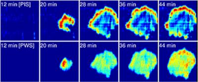 Focal Adhesions of Live Dental Stem Cells
