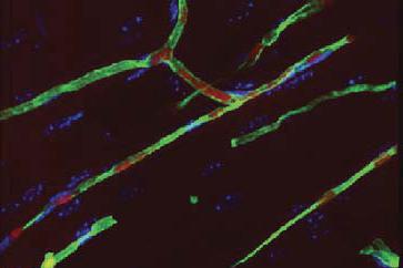 10 Month Blood Vessels