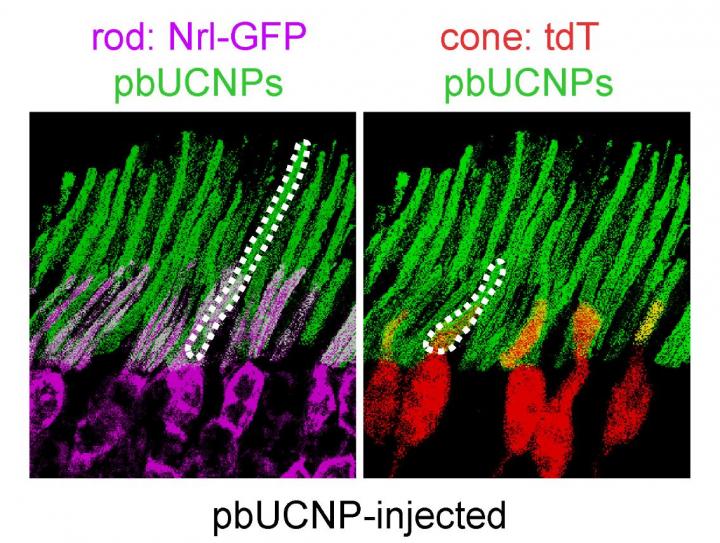 Nanoparticles Binding to Rods and Cones