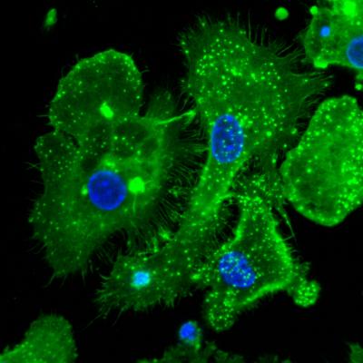 Heme-Treated Macrophages
