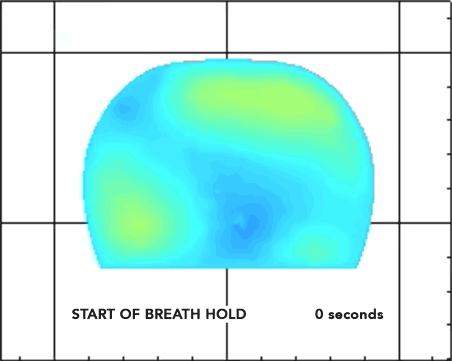 How the Breast Cancer Optical System Works