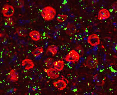 Proteasomes And Brain Cell Death