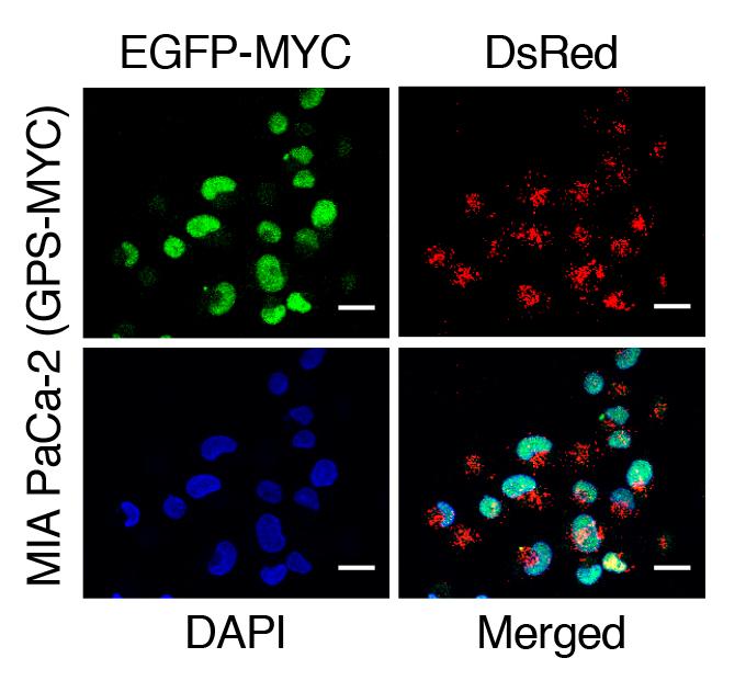 Drug Screening Reveals Therapeutic Target for 'Undruggable' Pancreatic Cancer (1 of 1)