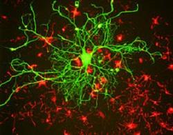 Rodent Neurons