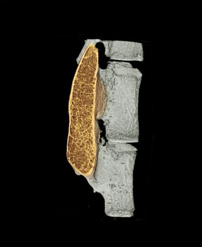 Micro-CT Image