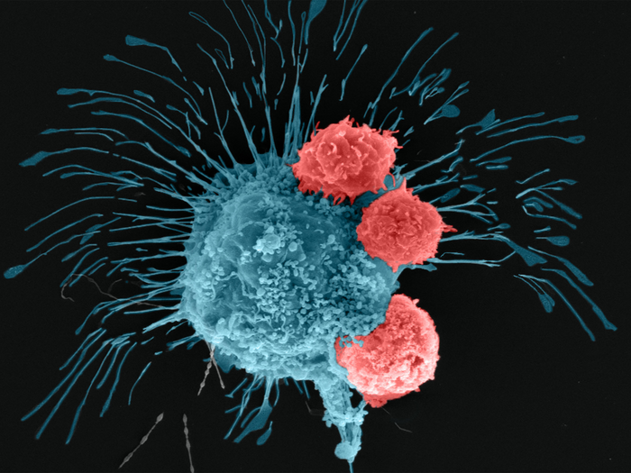 Bioprinted breast cancer cell