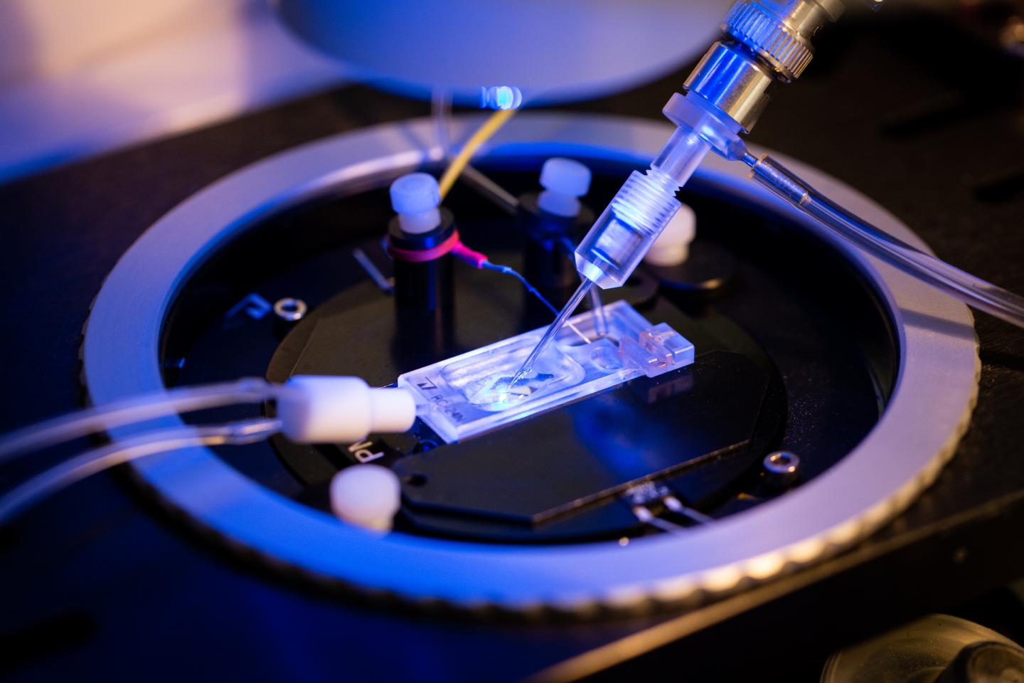 Patch Clamp Recording of Acid Activated Chloride Currents