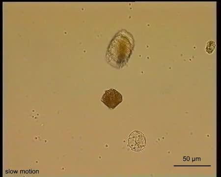 Evolution of Complex Ballistic 'Harpoons' in Microbes (2 of 11)