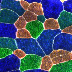 Skeletal muscle tissue sample