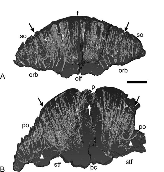 Neurovasculature in the dome