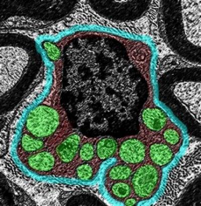Schwann Cell Surrounds Nerve Axons