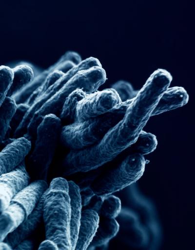 <i>Mycobacterium Tuberculosis</i>