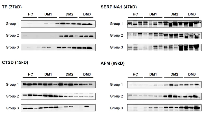 Validation of potential protein biomarkers using western blot