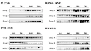 Validation of potential protein biomarkers using western blot