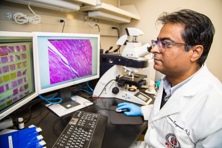 New Therapeutic Target for Spinal Muscular Atrophy