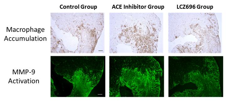 Heart Tissue Three Days after Myocardial Infarction