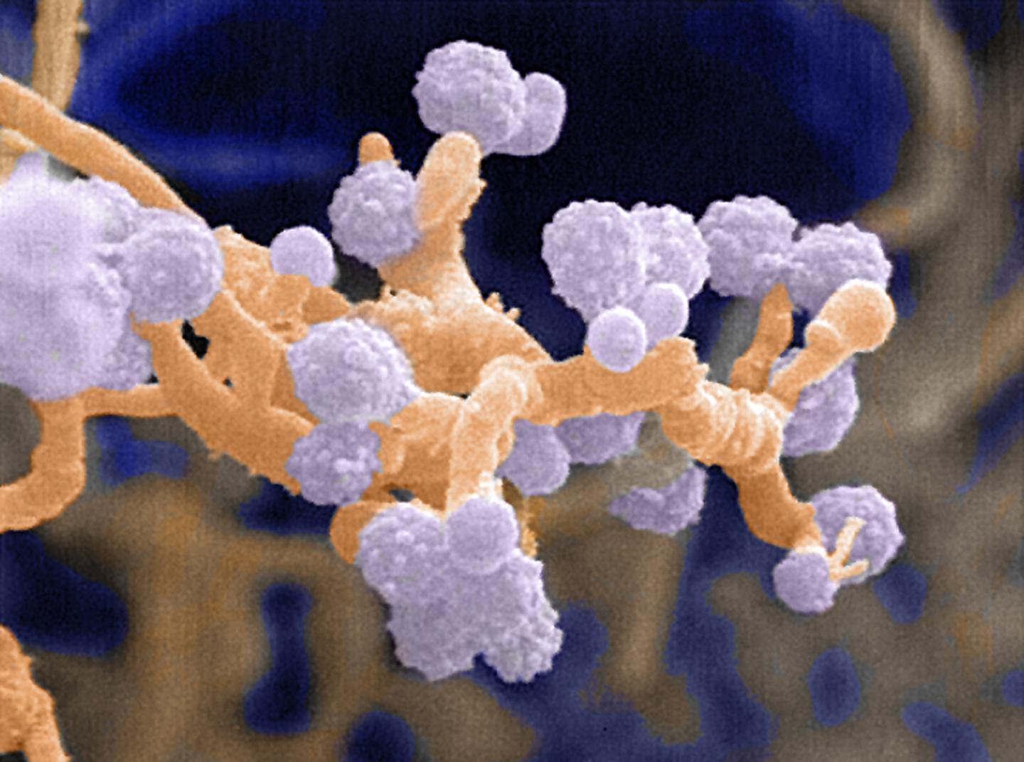 <i>Verrucosispora maris</i>