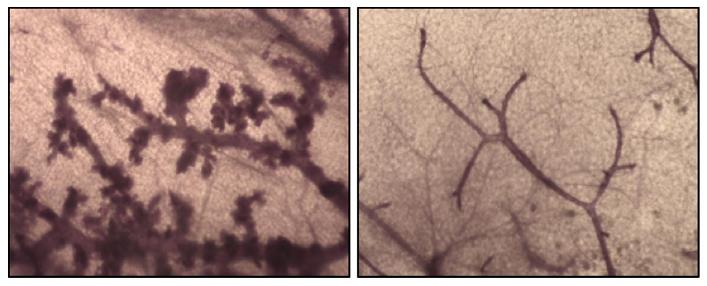 Accompanying Figure to the Latest Work on Breast Cancer/BRCA1