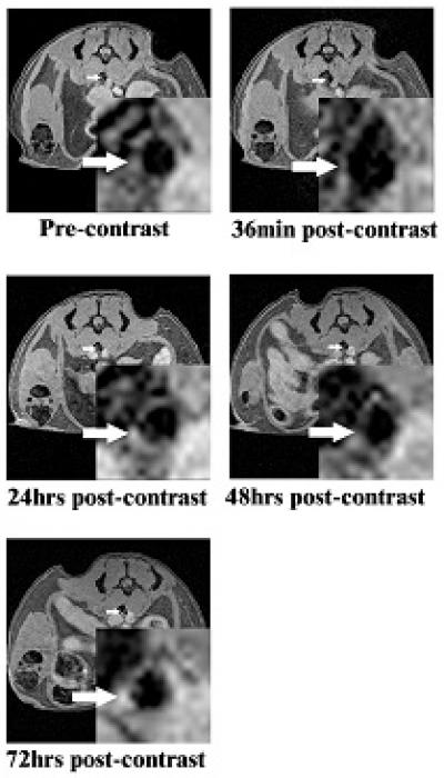 Imaging-Enhancement Technique
