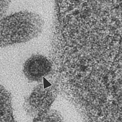 Electron Micrograph of Hervey Pteropid Retrovirus Following Release from a Human Cell.