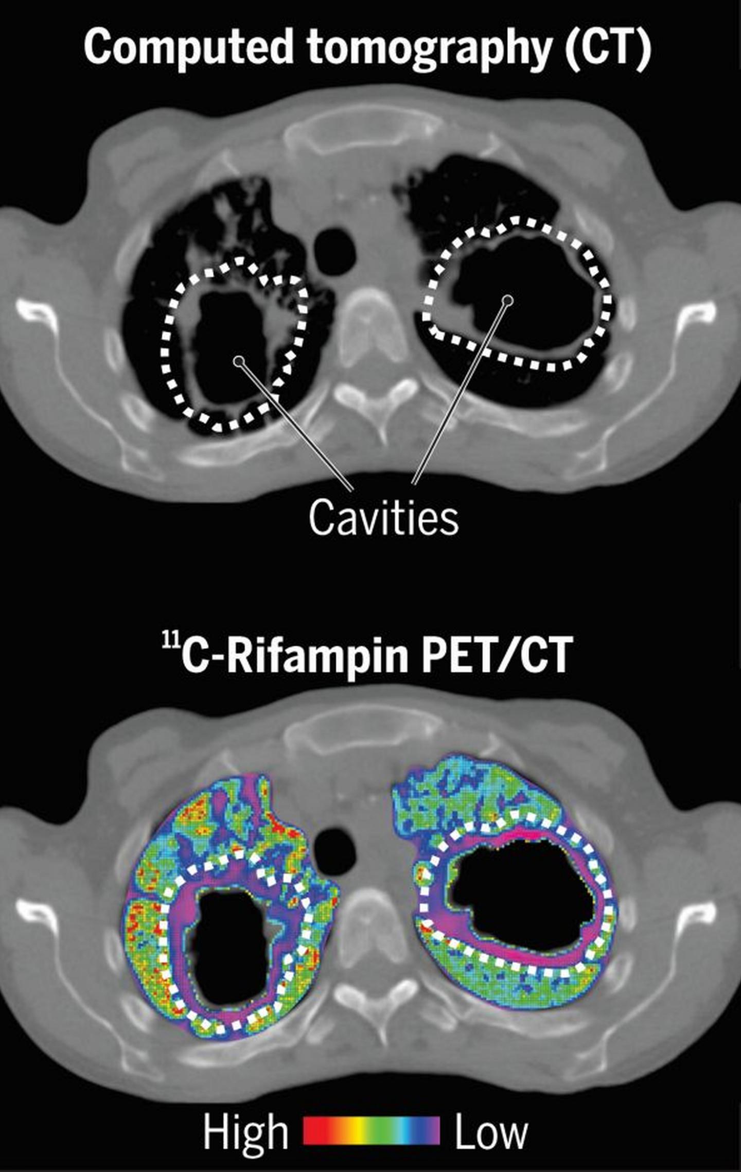 ET and CT Imaging