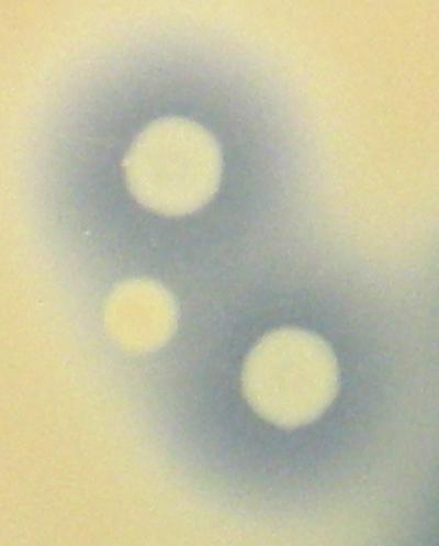 Control Over Bacterial Cheater [IMAGE] | EurekAlert! Science News Releases