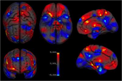 Males and Females Differ in Specific Brain Structures